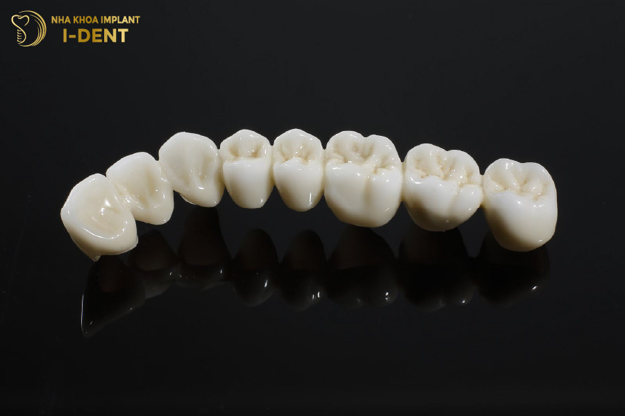 Hình ảnh răng sứ Venus cận cảnh, loại răng sứ toàn sứ cao cấp từ Đức, nổi bật với màu sắc tự nhiên và độ thẩm mỹ cao, thường được sử dụng trong phục hình răng thẩm mỹ.