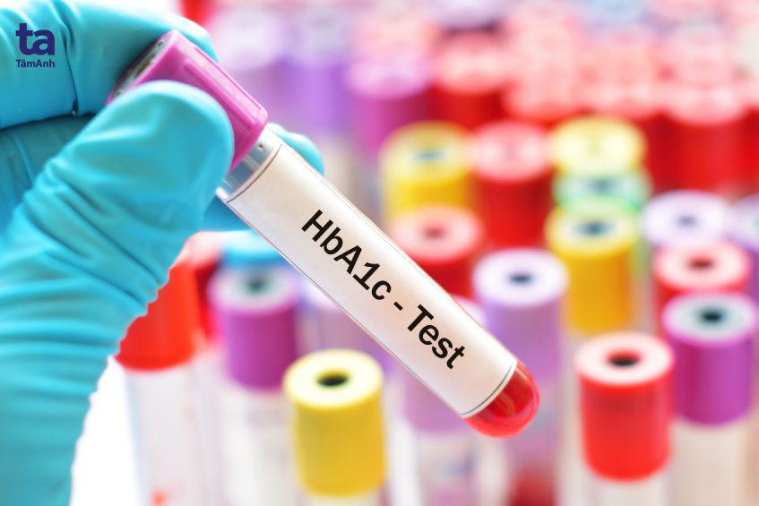 HbA1c-Test zur Messung des durchschnittlichen Blutzuckerspiegels