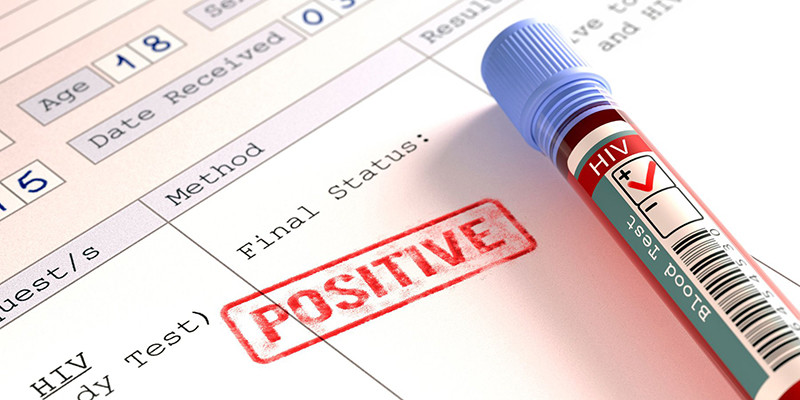 Kết quả xét nghiệm dương tính Covid-19 có nghĩa là bạn đã nhiễm virus SARS-CoV-2