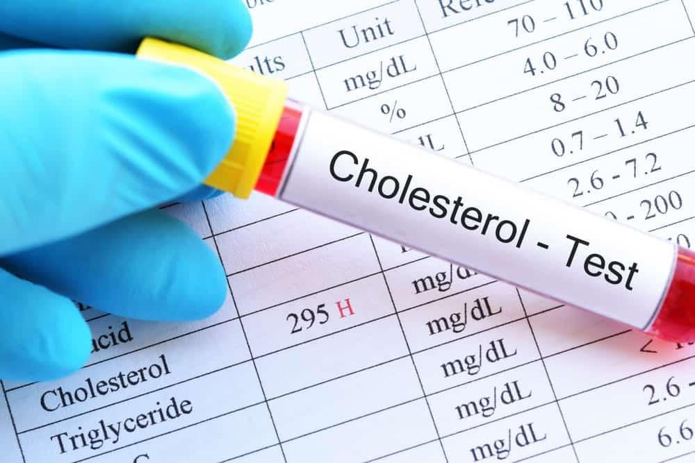 Cholesterol là gì? Cholesterol đóng vai trò quan trọng trong cấu trúc tế bào, tổng hợp hormone và sản xuất vitamin D.