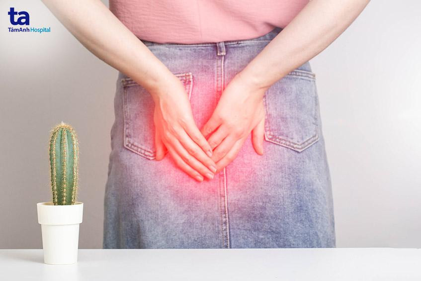 Hình ảnh minh họa các loại sa trực tràng khác nhau
