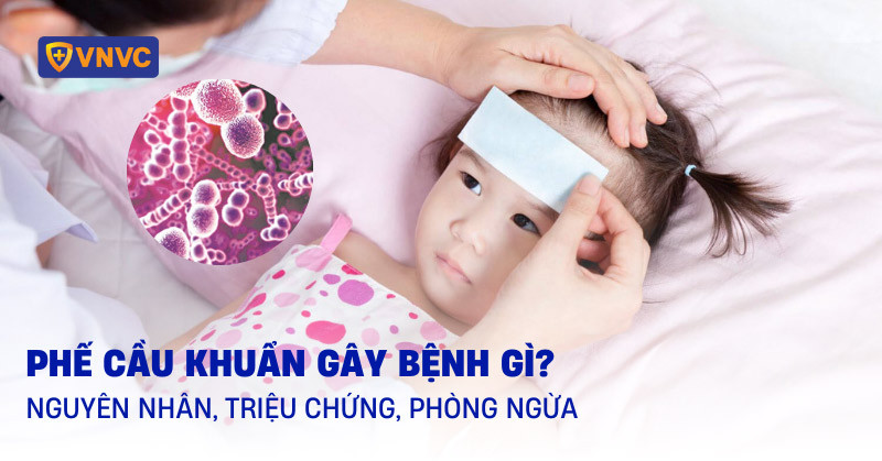 Phế cầu khuẩn là gì