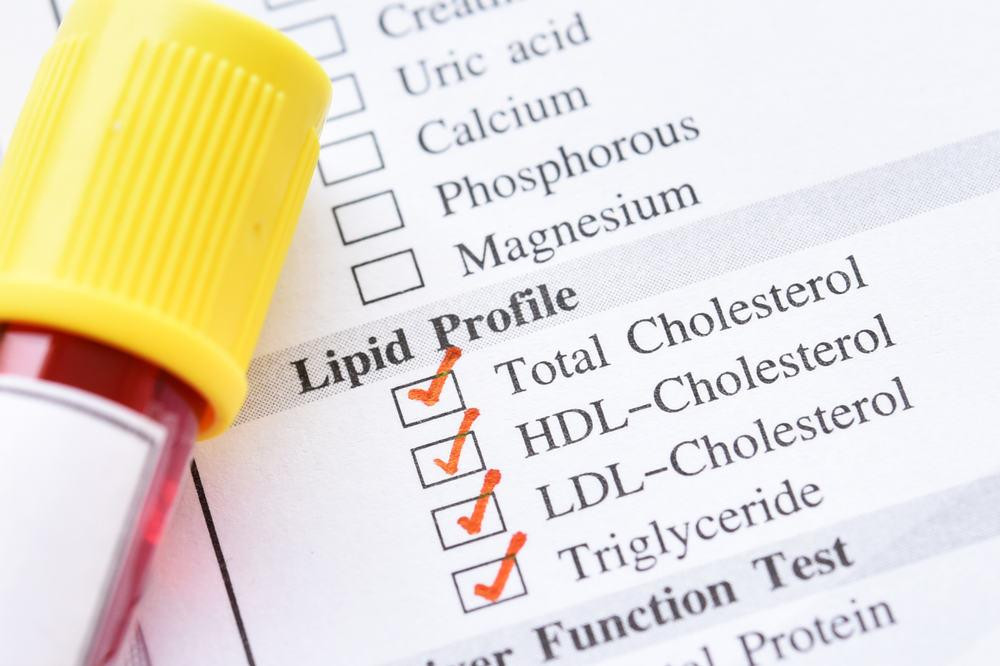 Ý nghĩa của chỉ số non-HDL cholesterol là gì? Non-HDL cholesterol là tổng lượng cholesterol có trong máu, trừ đi lượng cholesterol HDL (cholesterol "tốt").