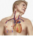 Catheter tĩnh mạch trung tâm
