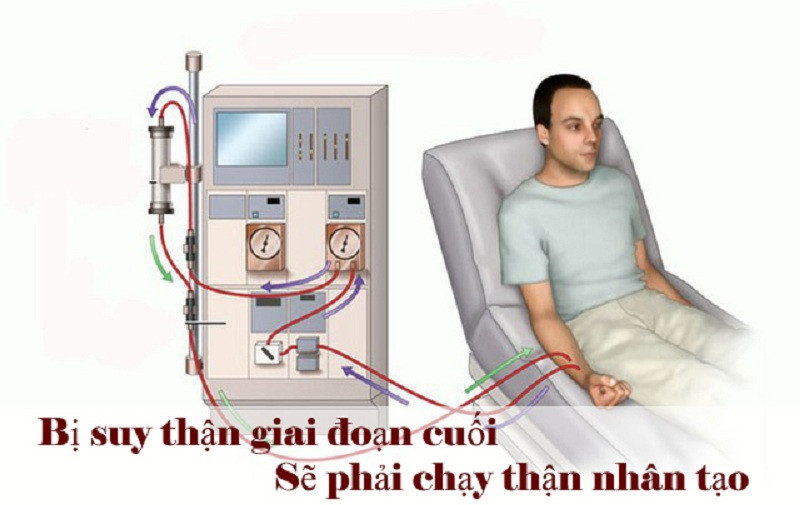 Suy Thận Gây Ảnh Hưởng Nghiêm Trọng Đến Sức Khỏe