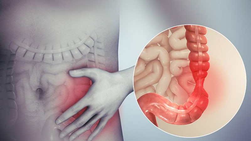 Hình ảnh minh họa vị trí đau đại tràng