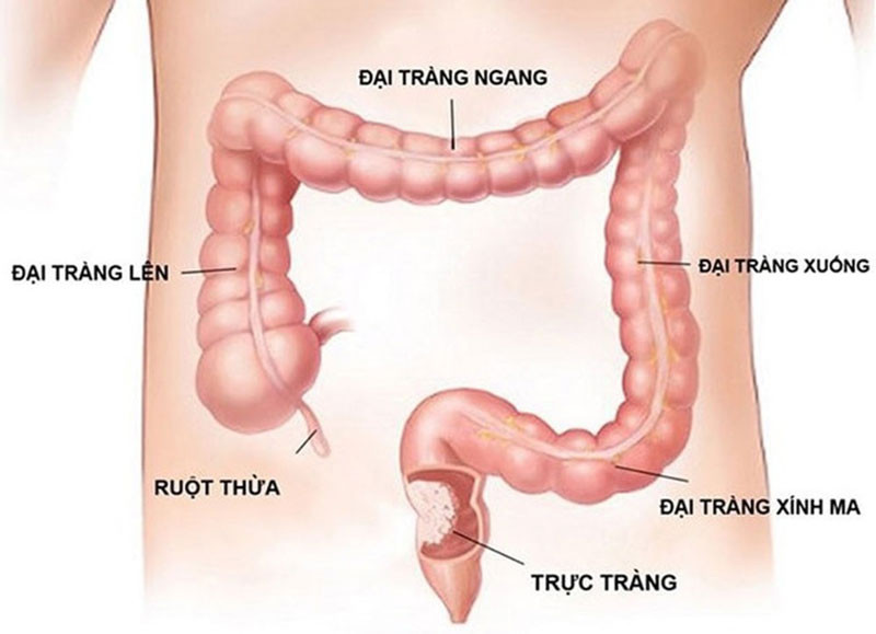 Hình ảnh minh họa cấu trúc đại tràng với các phần chính