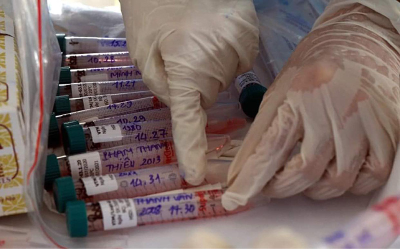 Điều kiện áp dụng test gộp COVID-19