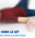 Bệnh động kinh là gì