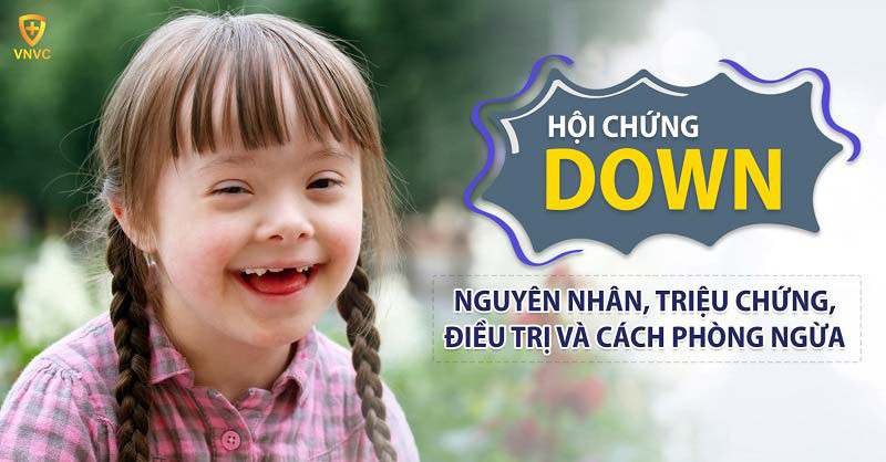 bệnh down ở trẻ em
