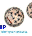 bệnh lỵ amip