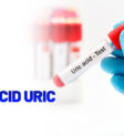 acid uric là gì vai trò và ảnh hưởng đến sức khỏe