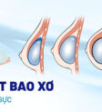 Co tháº¯t bao xÆ¡