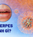 Virus Herpes Simplex