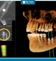 Lịch sử phát triển của cone kem