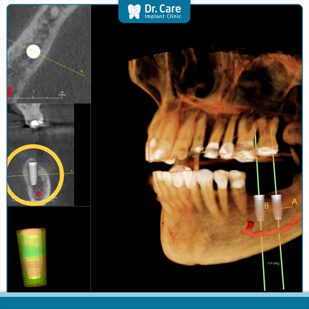 Lịch sử phát triển của cone kem