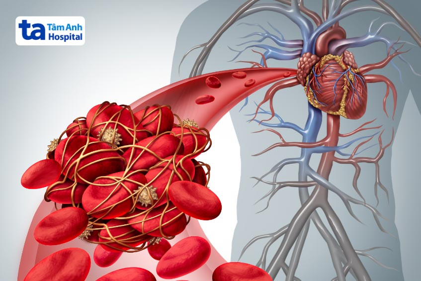 Động Mạch Đưa Máu Giàu Oxy Từ Tim Đến Các Bộ Phận Khác Trong Cơ Thể
