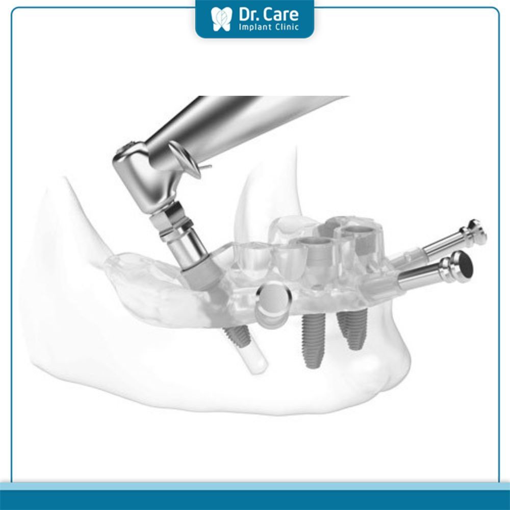 Công thức làm cone tại nhà đơn giản