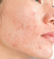 Rau kinh giới tươi ngon, một loại rau thơm quen thuộc trong ẩm thực Việt Nam