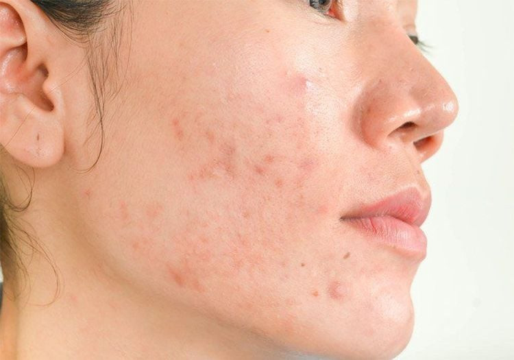 Rau kinh giới tươi ngon, một loại rau thơm quen thuộc trong ẩm thực Việt Nam