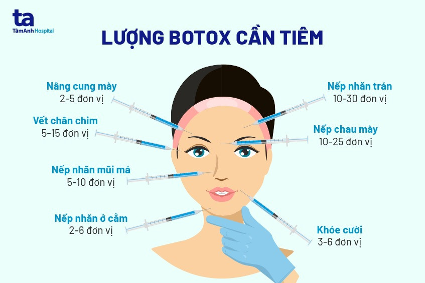 Những lưu ý quan trọng khi tiêm Botox