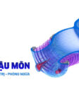 Nứt kẽ hậu môn là gì?