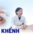 Răng khểnh