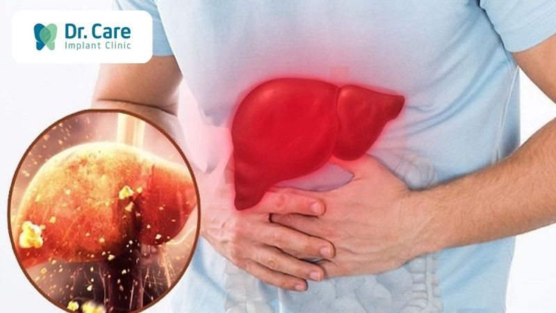Suy giảm chức năng gan có thể gây đắng miệng