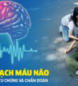 tai biáº¿n máº¡ch mÃ¡u nÃ£o