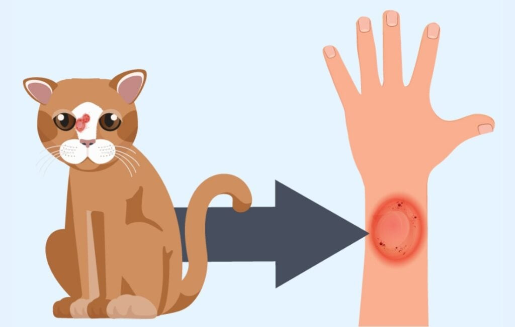 Lác đồng tiền có thể lây từ động vật