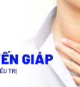 U tuyến giáp là gì?