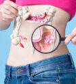 Hình ảnh polyp đại tràng