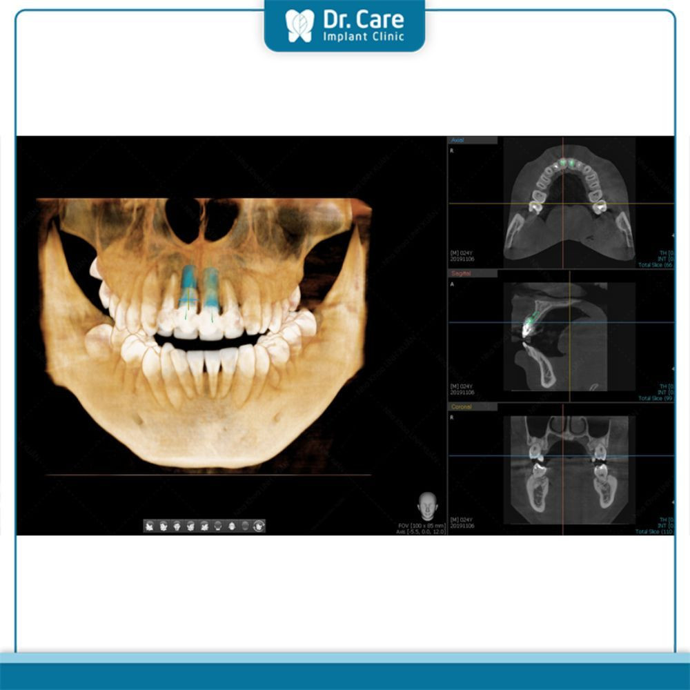 Ứng dụng đa dạng của cone trong ẩm thực Mỹ