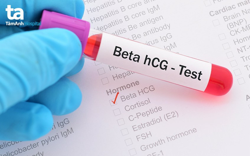 vì sao cần phải xét nghiệm hcg