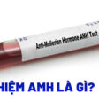 Hình ảnh minh họa xét nghiệm AMH