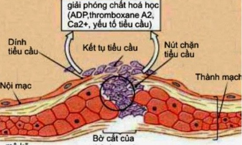 Xét nghiệm APTT giúp hỗ trợ trong việc kiểm tra rối loạn đông máu