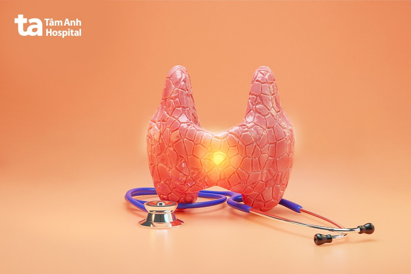 Xét nghiệm FNA tuyến giáp hỗ trợ phát hiện bệnh hạch lympho