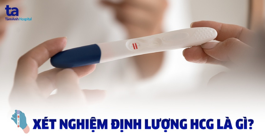 xét nghiệm beta hcg là gì